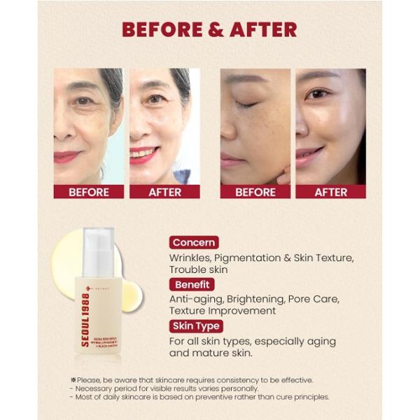 K-SECRET SEOUL 1988 Serum : Retinal Liposom 2% + Schwarzer Ginseng 30ml