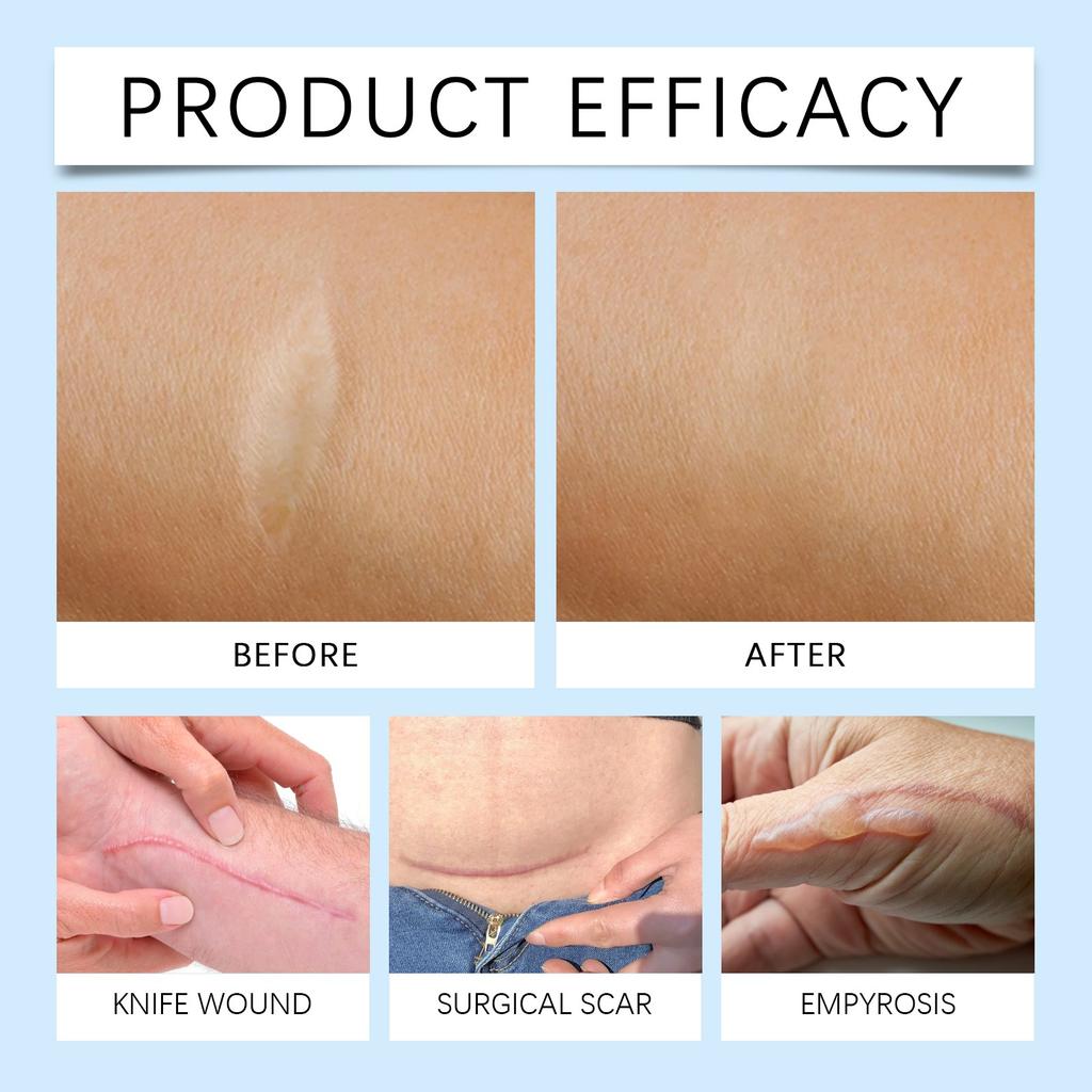 Self Adhesive Silicone Skin Patch For Repairing And Smoothing Skin Care Patches