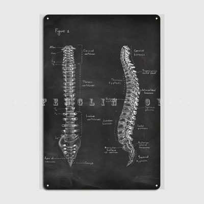 Anatomia Kręgosłupa Na Tablicy Kredowej Metalowy Znak Kino Kuchnia Kino Retro Malowidło Muralowe Blaszany Znak Plakat