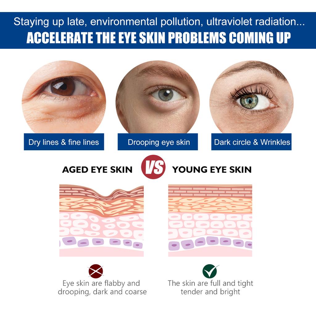 EELHOE Eye Anti-Wrinkle Cream Fades Fine Lines Anti Dark Circles Eye Serum Remove Eye Bag Puffiness Anti-Aging Firmness Eye Care