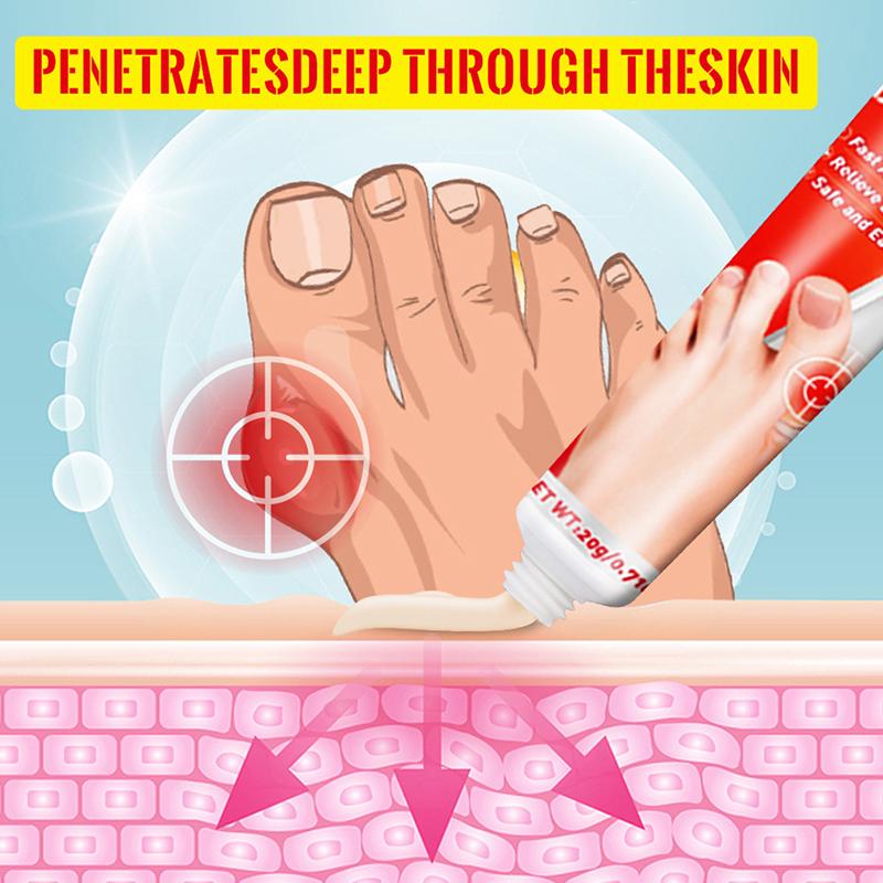 20G Bunion Gout Pain Relief Ointment Toe Joint Valgus Corrector Cream Hallux Knee Lumbar Arthritis Treatment Care Cream