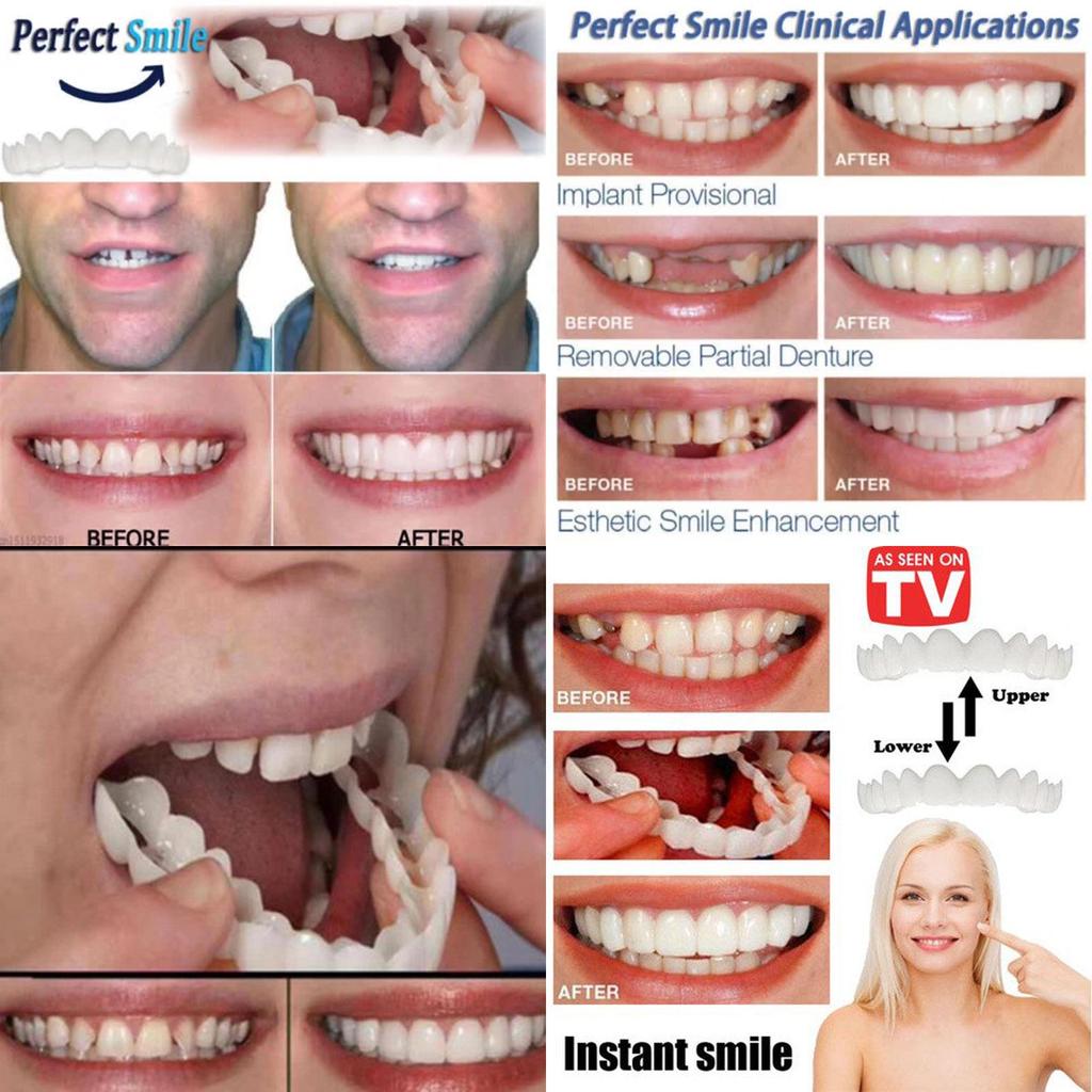Instant Comfort Smile Cosmetic Teeth Denture Teeth Top Veneer Cosmetic