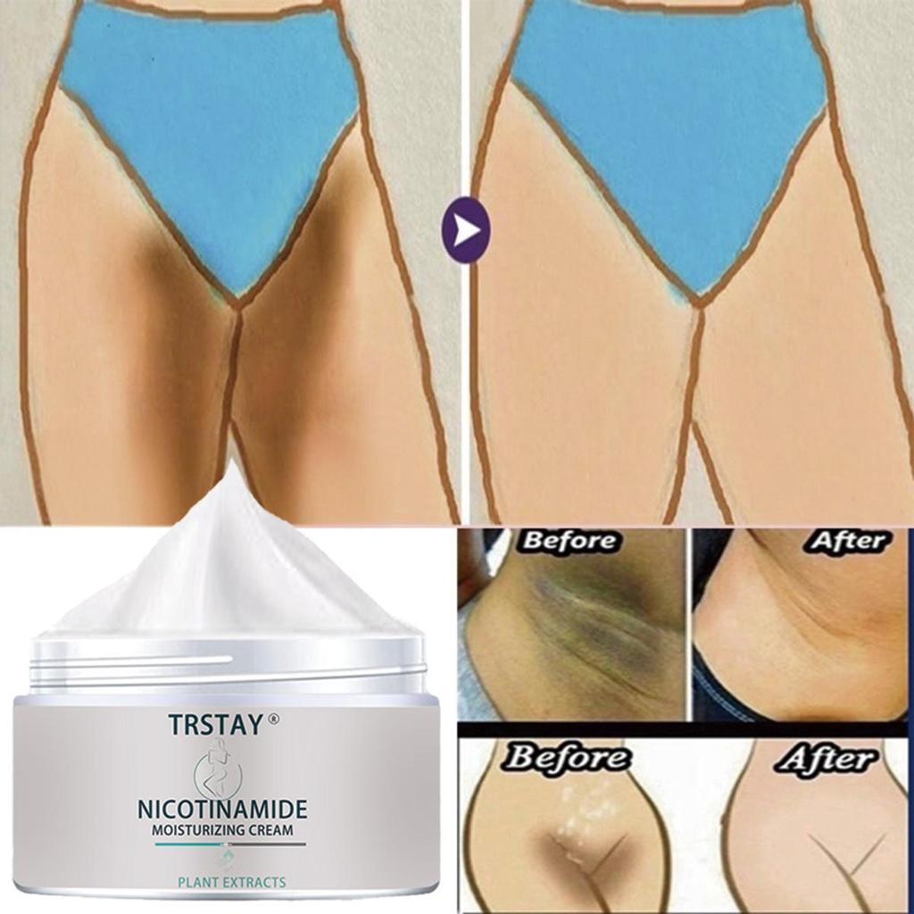 Whitening cream brightens the skin, deeply moisturizes, reduces wrinkles and fine lines, tightens the skin, and improves elasticity