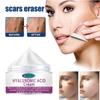 Scar Repair Cream Fade Post-scald Scar Moisturizing Repair Remove Cellulite Scar Cream