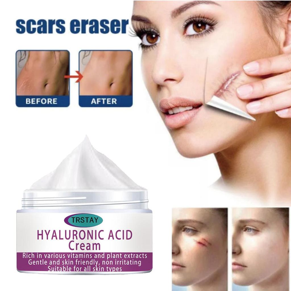 Scar Repair Cream Fade Post-scald Scar Moisturizing Repair Remove Cellulite Scar Cream
