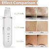 Skin Scrubber Face Skin Spatula Blackhead Remover Pore Cleaner Face Beauty Lifting Tool Comedones Extractor With 4 Modes, Facial Scrubber Spatula For