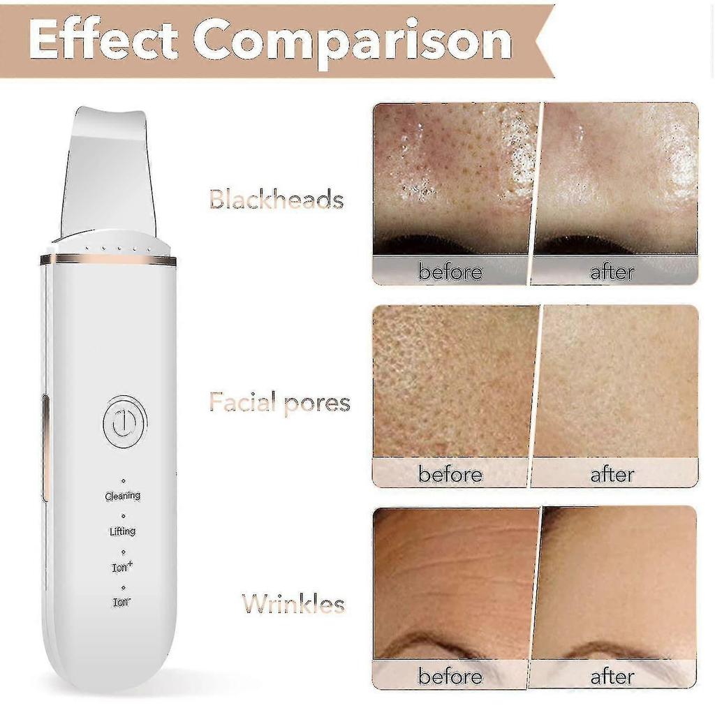 Skin Scrubber Face Skin Spatula Blackhead Remover Pore Cleaner Face Beauty Lifting Tool Comedones Extractor With 4 Modes, Facial Scrubber Spatula For