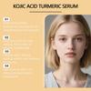 AMZ Kojic Acid Turmeric Serum | Exfoliates Dead Skin | Removes Blackheads | Minimizes Pores | Brightens Skin Tone | Nourishes Hydrating Serum