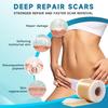 Silicone Scar Tape Reusable Sheet Scars Burns Tummy Chin Keloid Medi Grade for C-section - Cut To Size, 60 Inch