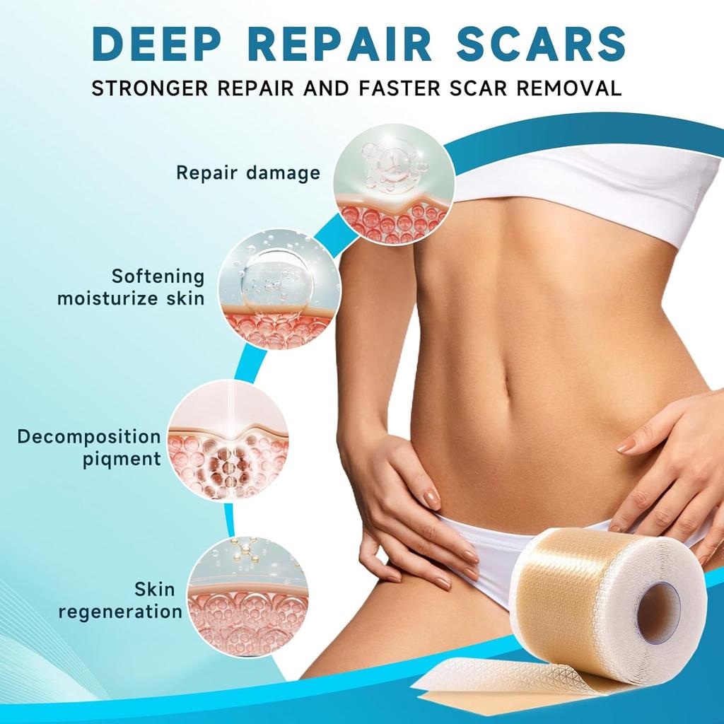 Silicone Scar Tape Reusable Sheet Scars Burns Tummy Chin Keloid Medi Grade for C-section - Cut To Size, 60 Inch