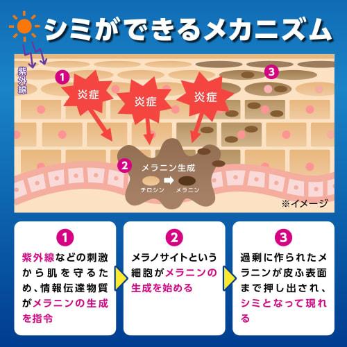 [Bulk Purchase] [Kobayashi Pharmaceutical] Men's Keshimin Lotion [For stains and freckles!] Keshimin Men's Keshimin Contains tranexamic acid/Quasi-dru