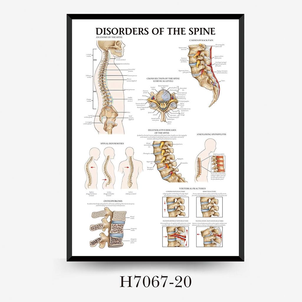 Human Tissue Structure Muscle Gym Medical Education Decorative Canvas Painting Poster Wall Art for Home Decor
