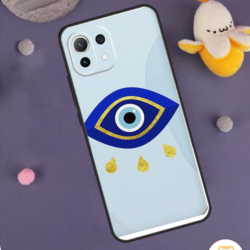 Big Eyes Cartoon Pattern Case For Xiaomi 15T 13T 14T Pro 14 15 Ultra 17 Pro Max POCO X7 X6 X5 F5 F6 F7 F8 Pro Cover