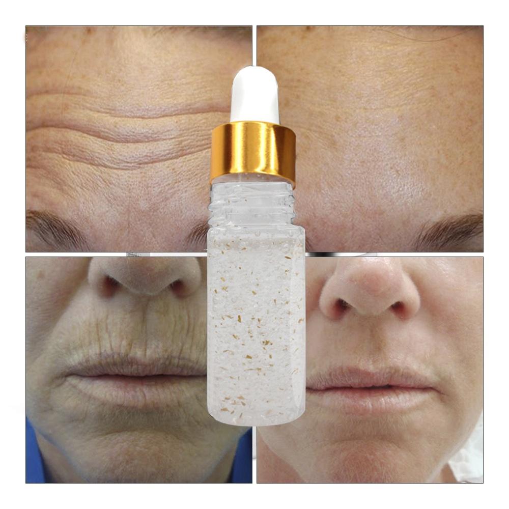 Buy Massage Essential Oils, Eliminate Excess Body Fat, Burn Belly Fat