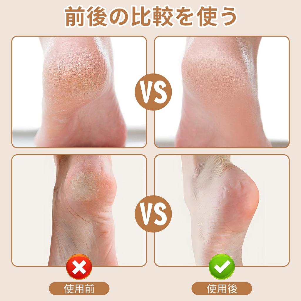 Coollooda Electric Callus Remover for USB 3 3 Electric Callus Roller for Dry and Wet LCD Battery Level Unisex Heels, Rechargeable, Rollers, Speeds,