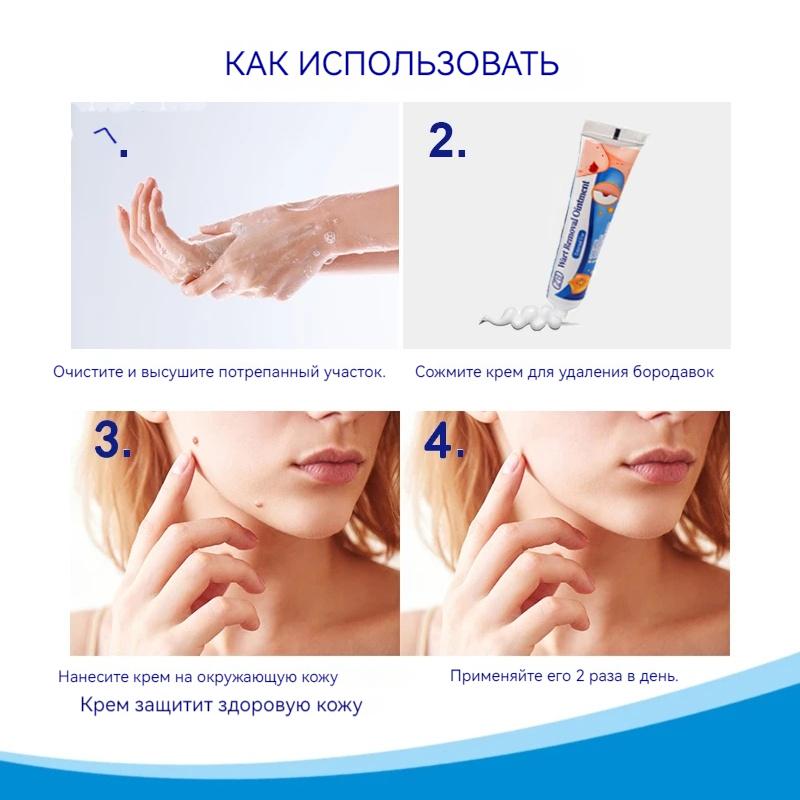 ZB Mole Removal Ointment Skin Care Mild Ingredients Collagen Daily Skin Care