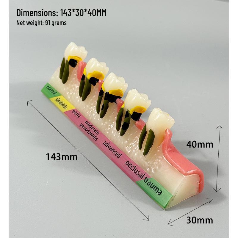 Прозора Знімна Повна Модель Щелепи з М'якими Яснами та Зубами для Підготовки до Імплантації