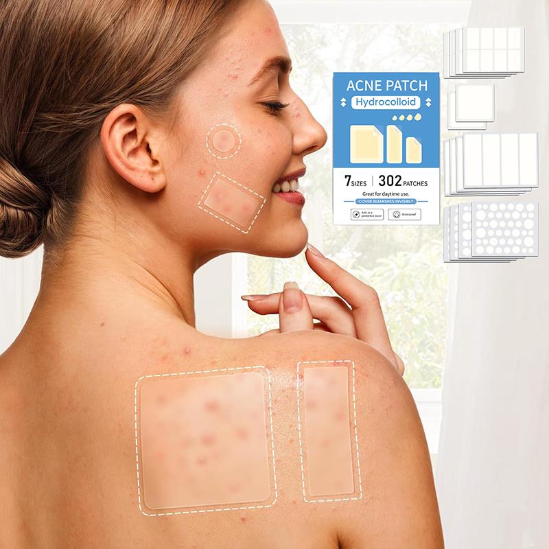 302Pcs Acne Patch Repair Acne Cleansing Invisible Breathable Waterproof Acne