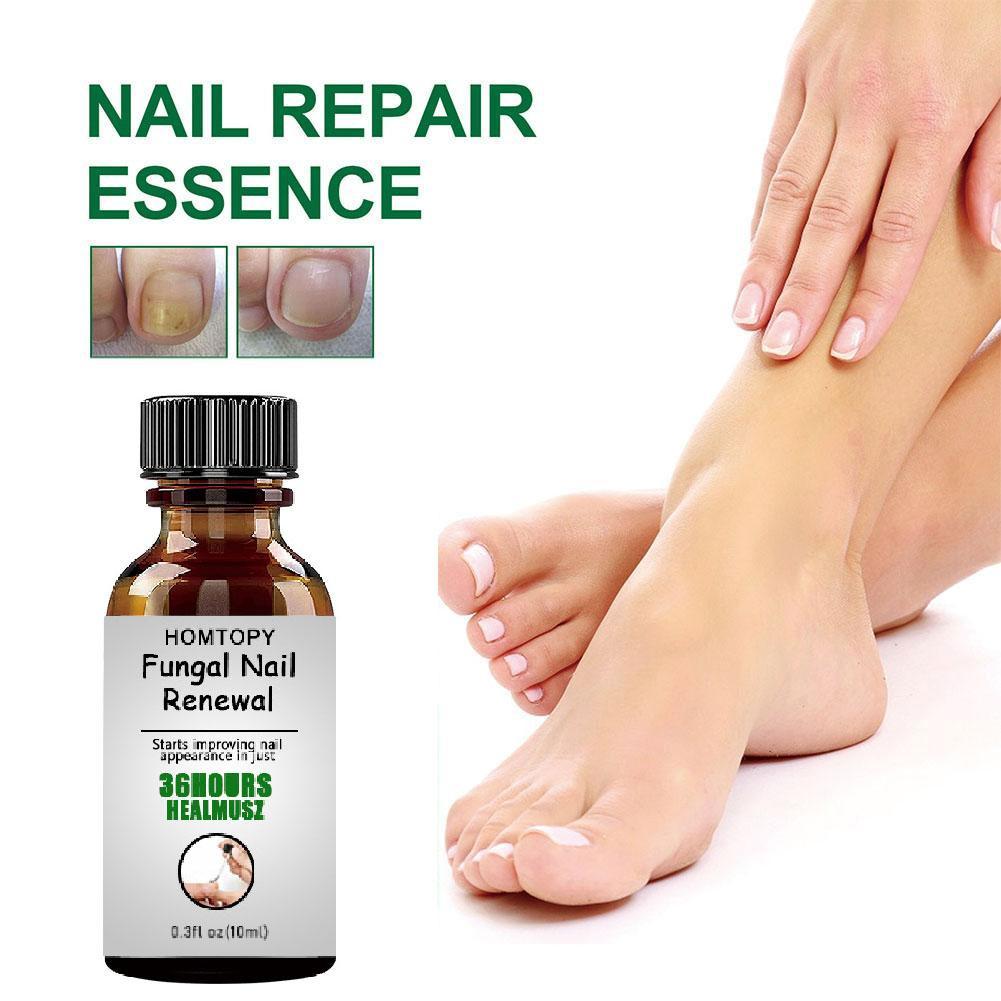10ML Toenail Nail Fungus Treatment Repair Fingernail Device Foot Toenail Fungus Essential Care F0N3