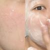 Acleon Acne Cleansing + Pore Ampule 15ml