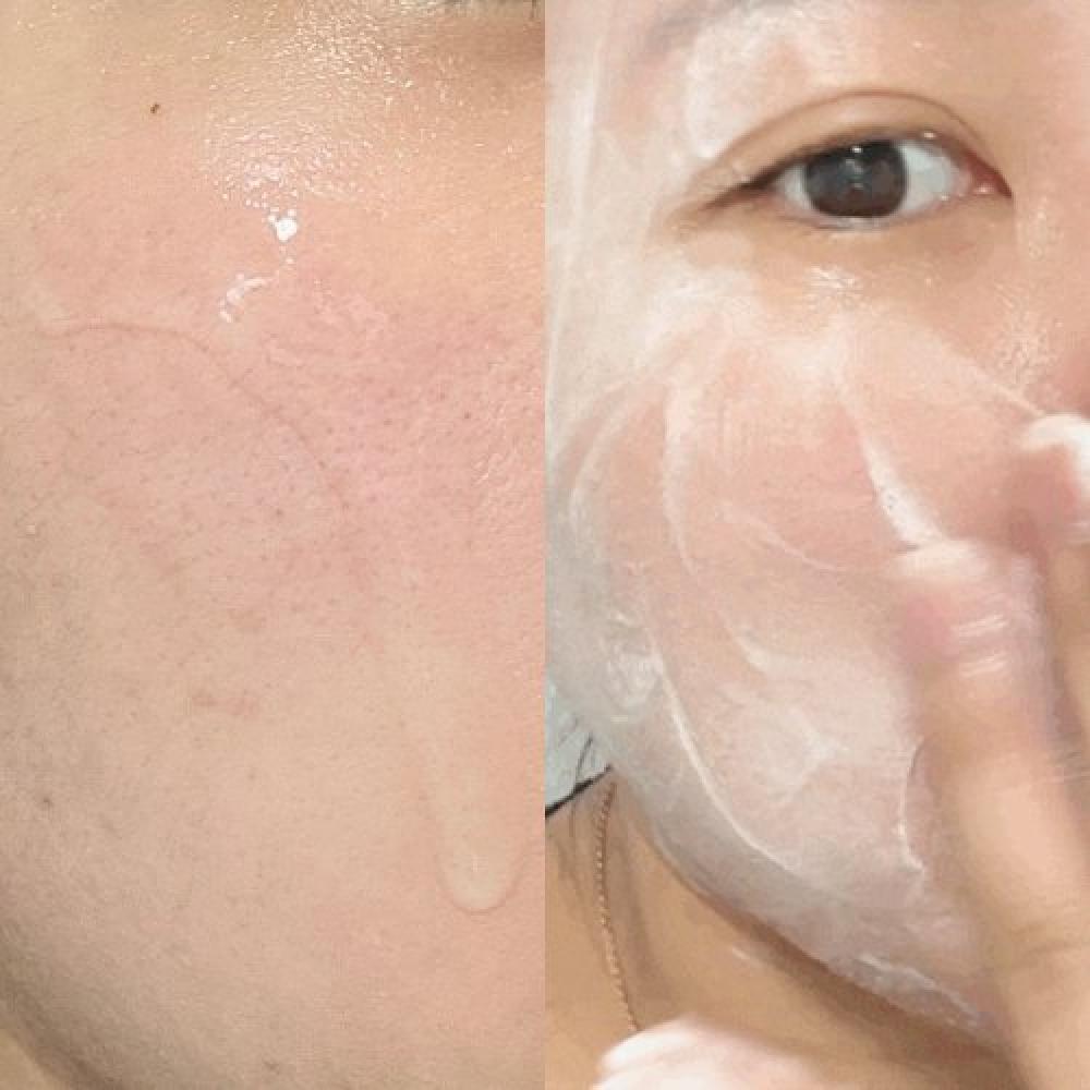 Acleon Acne Cleansing + Pore Ampule 15ml