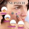 SADOER Colorful Star Acne Patch Student Acne Removal Acne Repair Patch