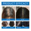 Hair Care Essential Oil Roller Applicator Prevent Hair Loss Nourish Roots Peppermint Essential Oil Quick