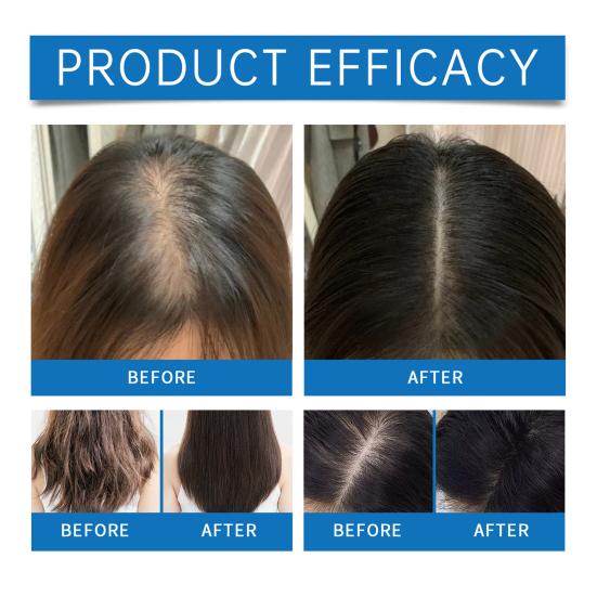 Hair Care Essential Oil Roller Applicator Prevent Hair Loss Nourish Roots Peppermint Essential Oil Quick