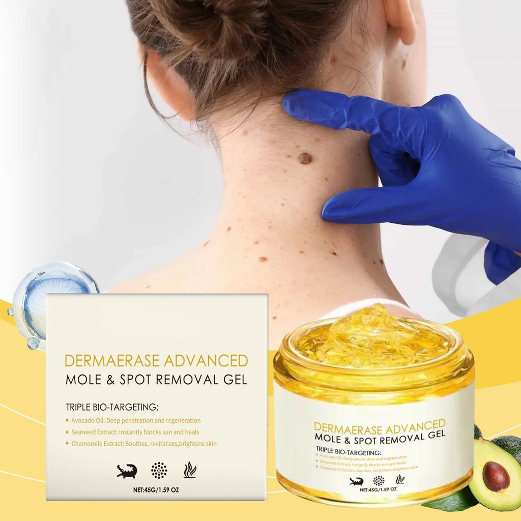 Freckle Removing Nevus Gel Whitening And Rejuvenating Skin Lightening Sun Freckle Brightening Skin Cream