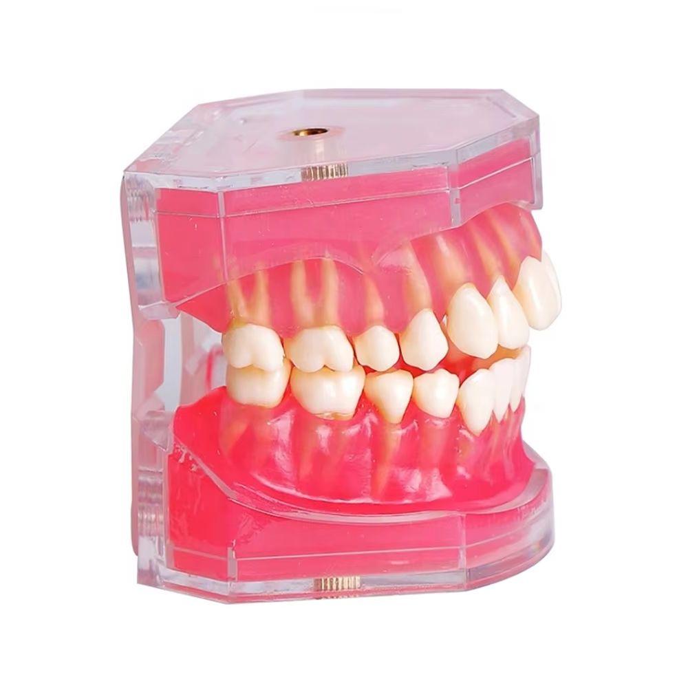 Dental Model with Removable Teeth Jaw Typodont Soft Gum Adult Standard Dentistry Teaching Studying Demonstration Teeth Model
