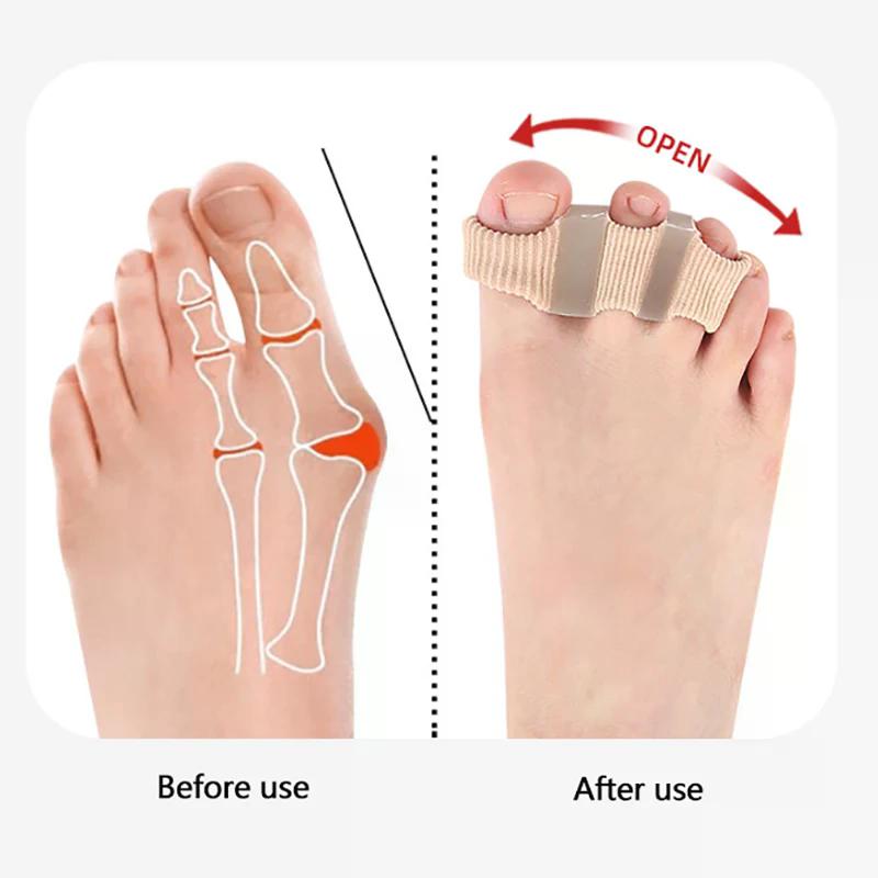Five Hole Fiber Toe Corrector For Thumb Valgus Big foot Bone Overlap - Toe Separator Three Hole Orthotic Device Toe Straightener