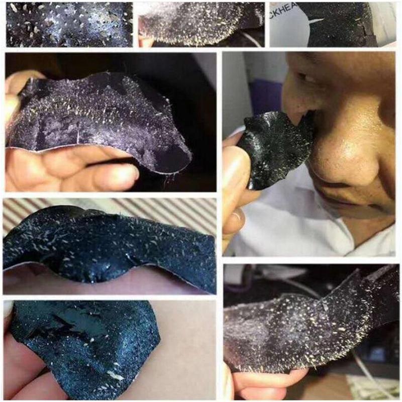 20pcs Blackhead Nose Strips Deep Cleansing Nasal Spot Facial Dot Stickers Nose Mask Shill For Acne & Black Head