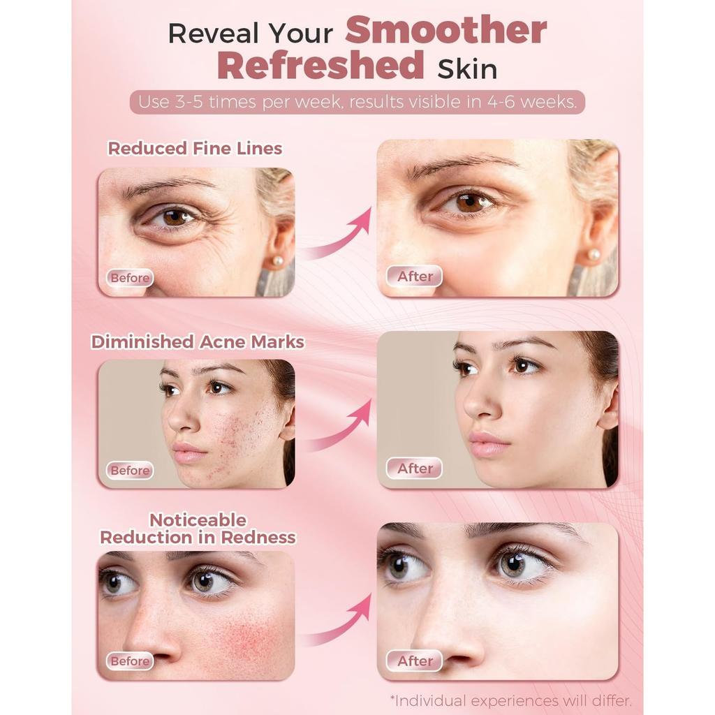 Red Light Therapy Mask for Face, LED Face Mask Light Therapy with Remote, Portable Infrared Light Therapy Skin Care Device with Timer Function