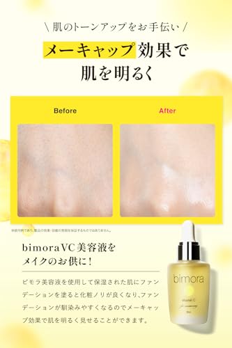 BimoRa 30% Vitamin C Derivative High-Concentration Serum for Skin Irritation, Anti-Aging Care, Pore Care, Acne Treatment, Skin Texture Improvement, Mo