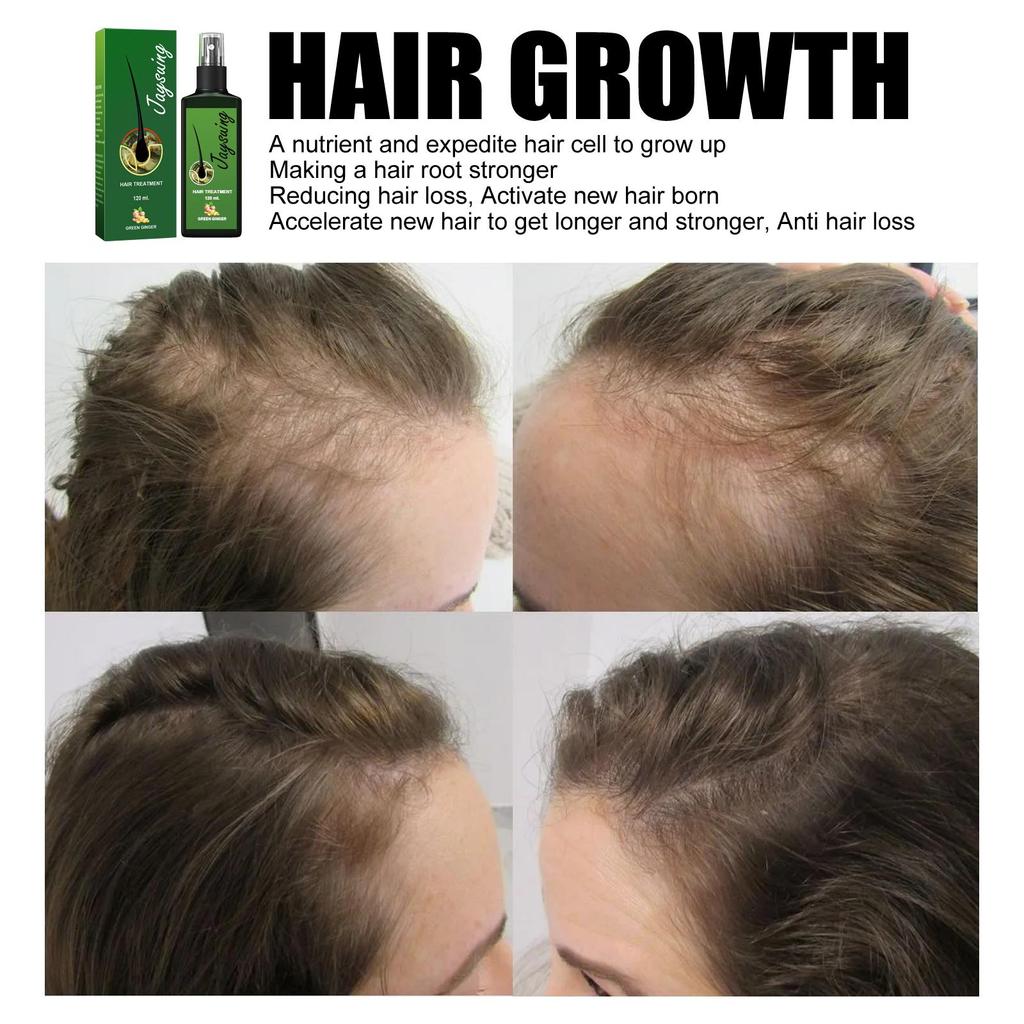 Jaysuing Hair Care Liquid 30ml Anti-Hair Loss, Strengthens Hair, Promotes Hair Growth, Repairs Hair Roots, Gentle Nourishing Hair Care Spray