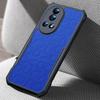 XUNDD For Huawei Nova 12 Pro 5G/nova 12 Ultra 5G Case Acrylic+TPU Protective Back Cover