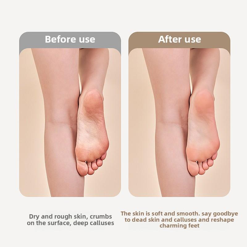 Electric Rechargeable Pedicure Mechanized Foot Grinder Foot Skin Dead Skin Knife Callus Foot Grinder Foot Trimmer