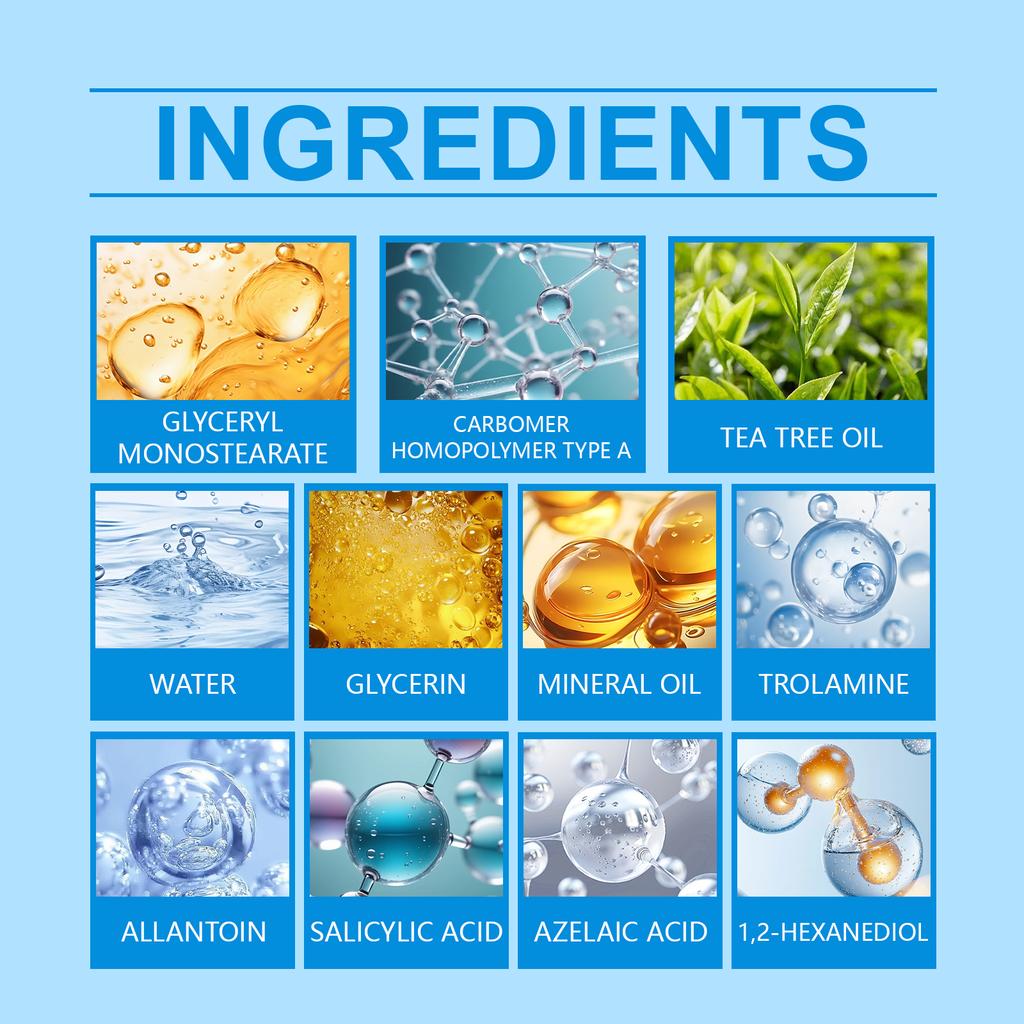 Azelaic Anti-acne Cream Soothes Acne, Purifies And Moisturizes The Skin, Improves Skin Texture, And Acne Cream