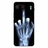 For Oneplus Nord 2 / Nord 3 / Nord 4 Case Soft Silicone Lion Cat Fashion Back Cover For Oneplus Nord 4 Cases Nord4 Protector TPU