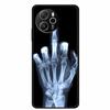 For Blackview Shark 8 6.78''Cases Animal Painted Soft TPU Silicone Back Cover for Black view Shark 8 4G Fashion TPU Phone Cases