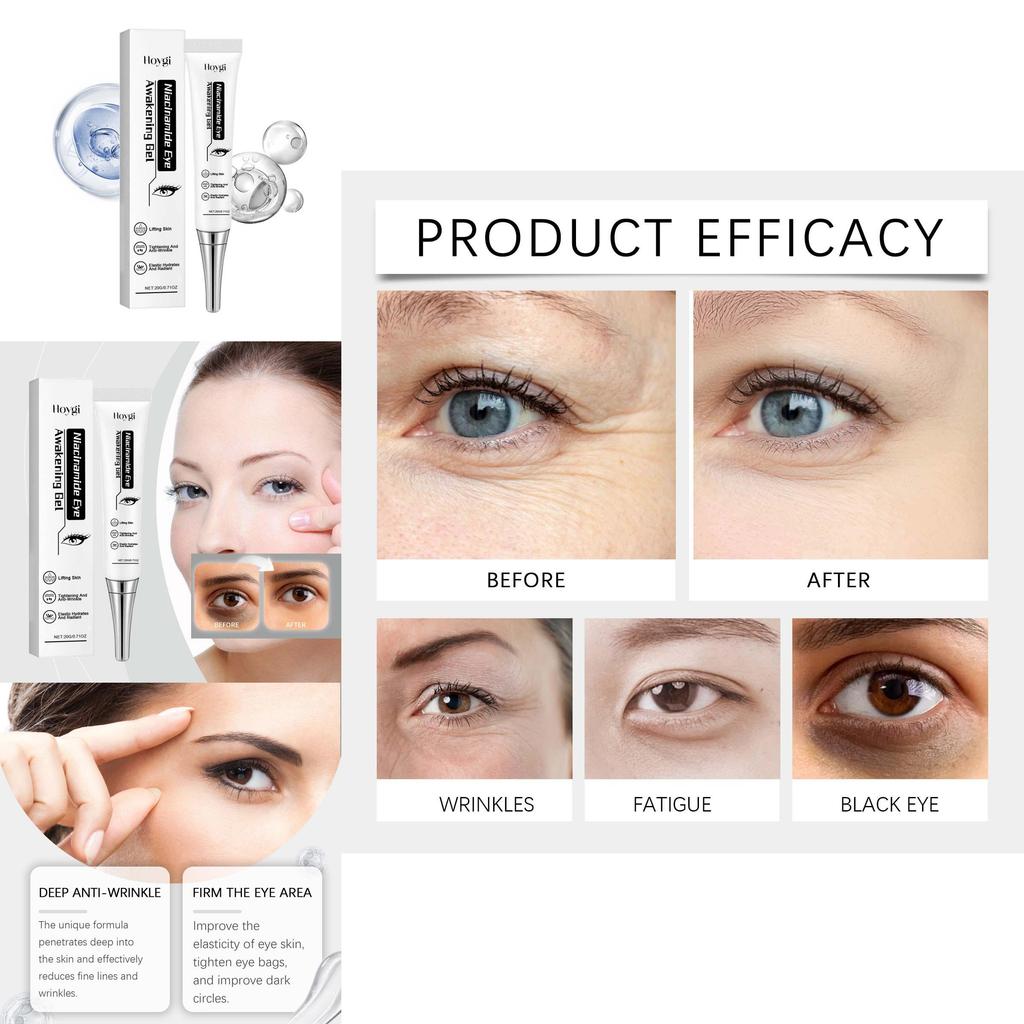 Hoygi Niacinamide Eye Gel Hydrating Nourishing Firming Skin Care Moisturizing Cream