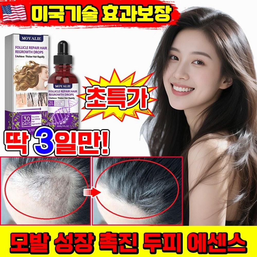 LUPEIYA Haarausfall Ampulle Kopfhaut Nährende Essenz Haarwachstum Fördern Serum Haarausfall Nährstoff Haar Essenz Kopfhautpflege 1 Stück 30ml