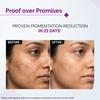 The Derma Co 2% Kojic Acid Face Serum, 30ml