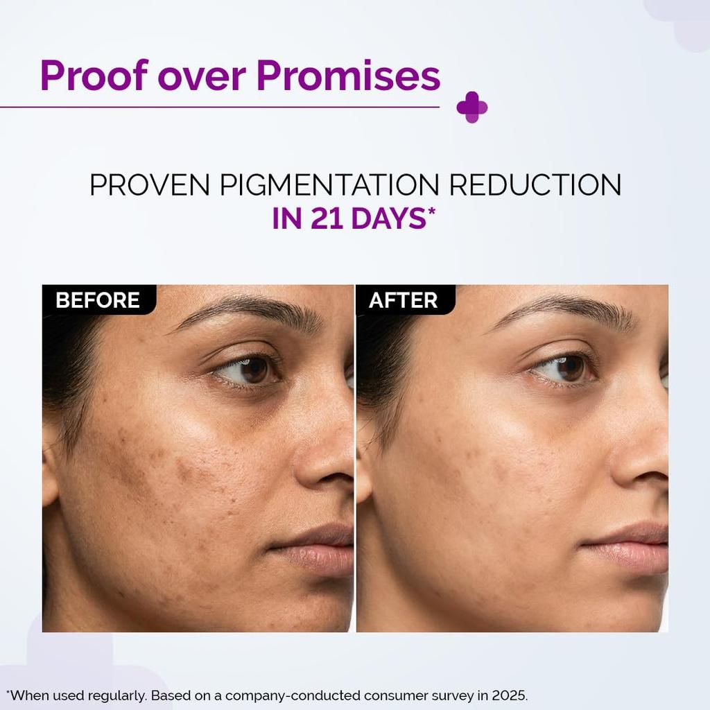The Derma Co 2% Kojic Acid Face Serum, 30ml