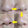 10pcs Blackhead Nose Strips Deep Cleansing Nasal Spot Facial Dot Stickers Nose Mask Shill For Acne & Black Head - Dropship