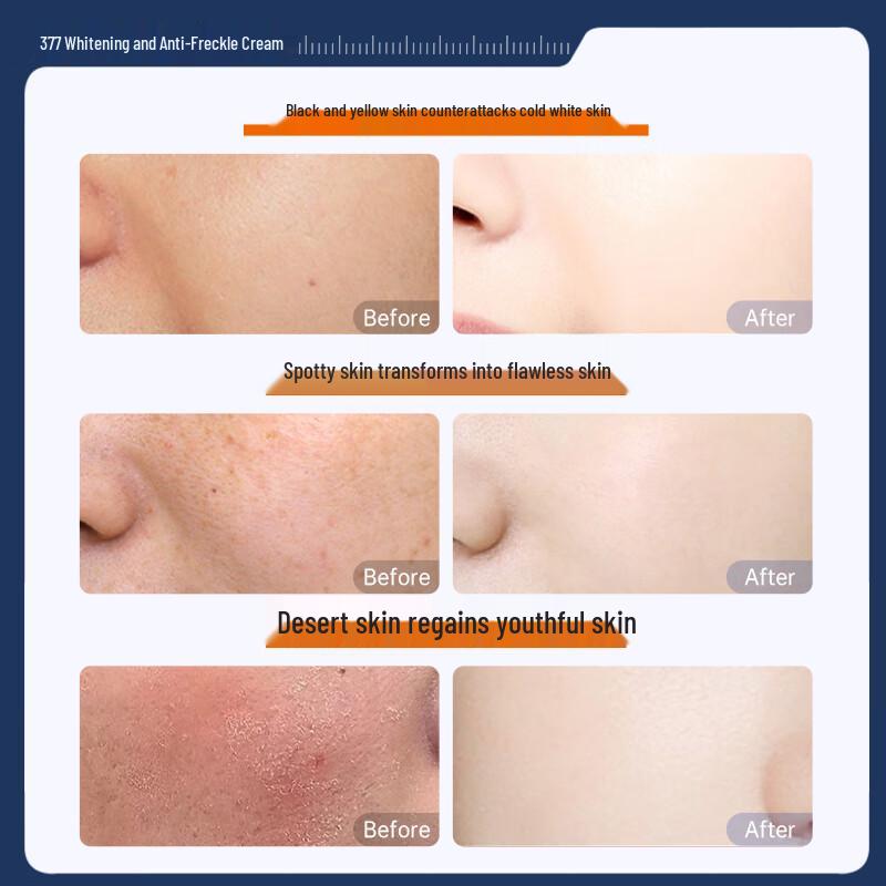 Yuranmei 377 Whitening & Spot-Fading Face Cream