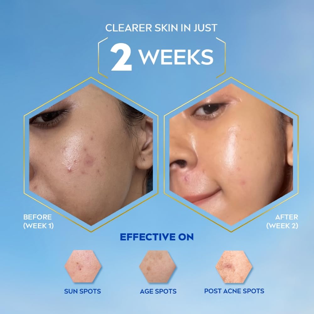 Nivea Luminous Even Glow SPF 50 Day Cream For Face With UV Protection, Oil Control, Dark Spot Reduction, Moisturizer 40ml