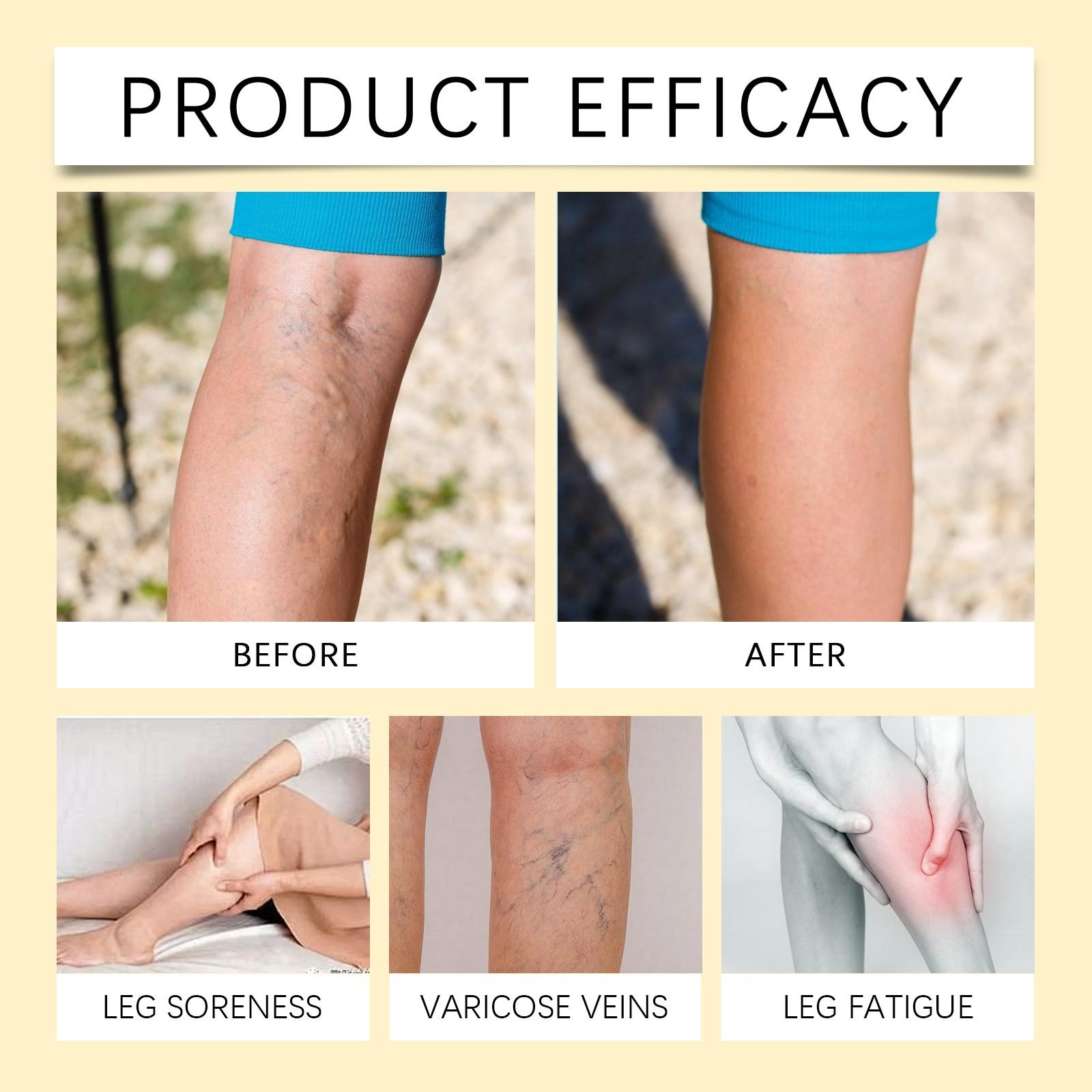 Крем для ухода за ногами на основе трав — фото 3