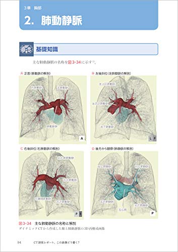 How to write a CT image reading report? - Basic knowledge of anatomy and findings, and examples of reports for common diseases