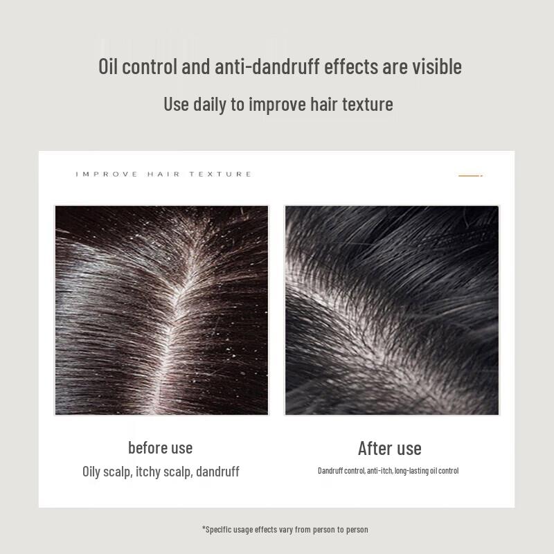 Green Valley Coconut Oil Anti-Dandruff Shampoo